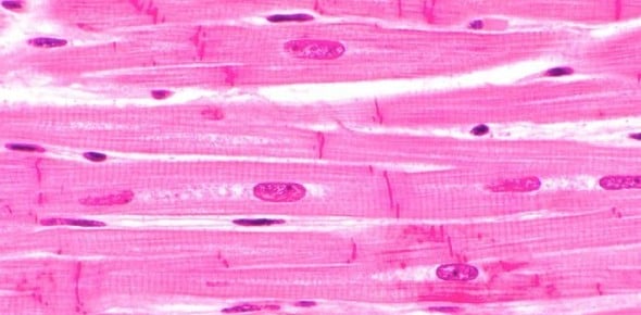 Identify These Cardiac Muscle Tissue Slides Flashcards